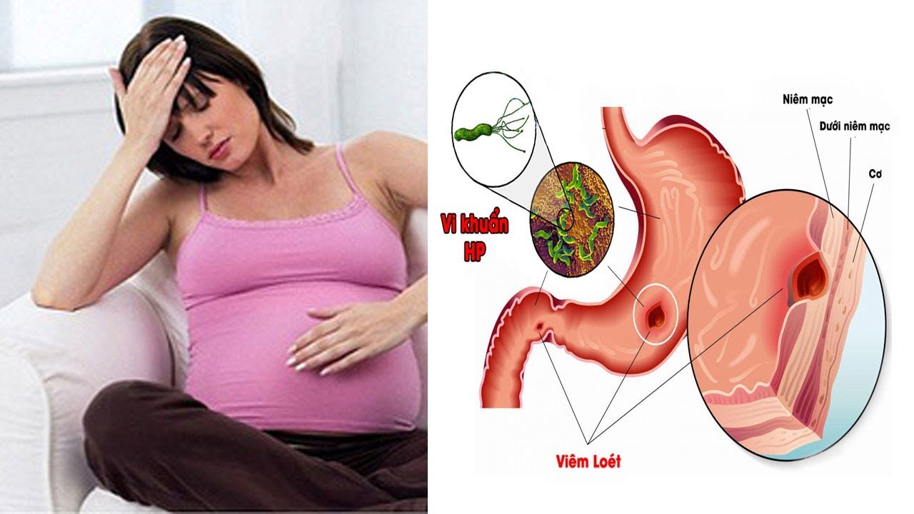 Bà bầu bị đau dạ dày khi mang thai