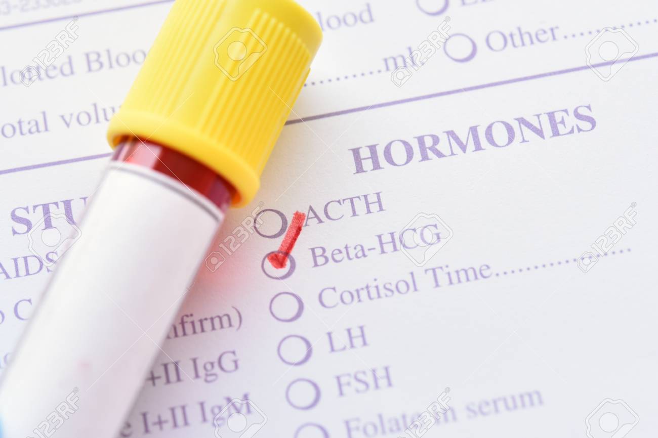 Xét nghiệm beta HCG giúp mẹ bầu xác định tuổi thai
