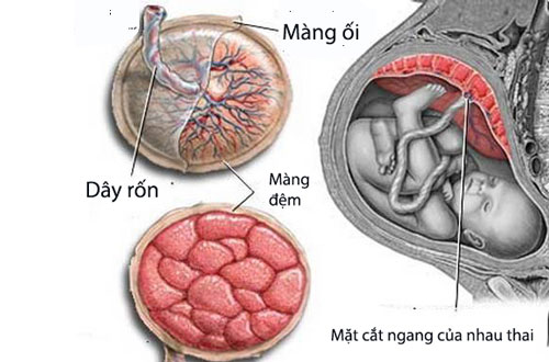 dau bung ra mau khi mang thai
