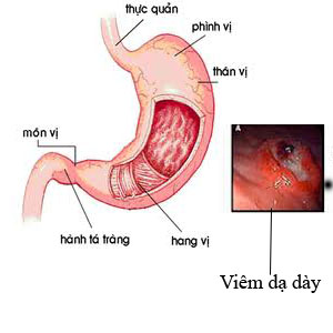 dau da day cap tinh