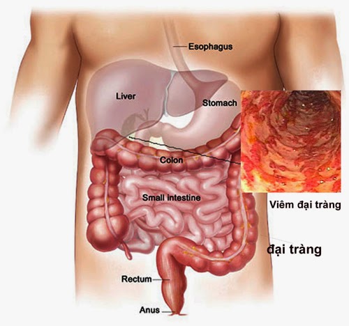 dau da day di long ngoai