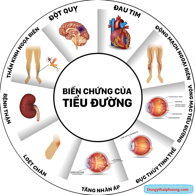 nguyên nhân bệnh tiểu đường