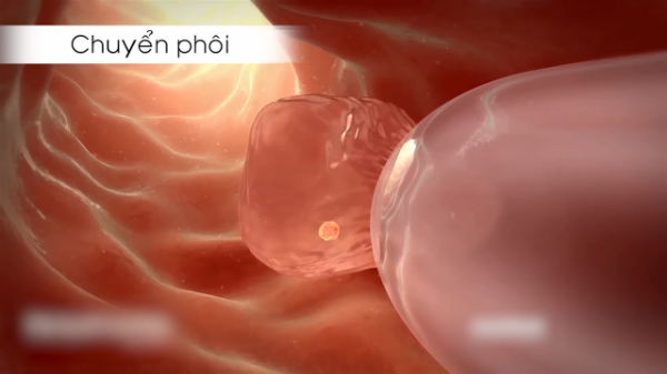 Sau chuyển phôi 21 ngày có những dấu hiệu gì