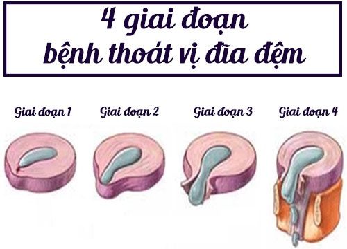 thoat vi dia dem